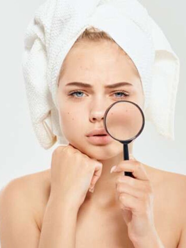 Skincare ingredients for dark spots